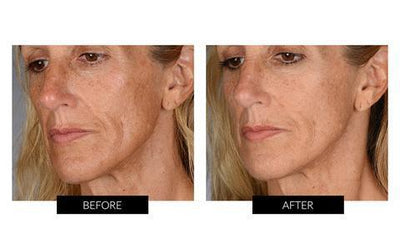 BeautyBio The Complete Glo (worth $943)